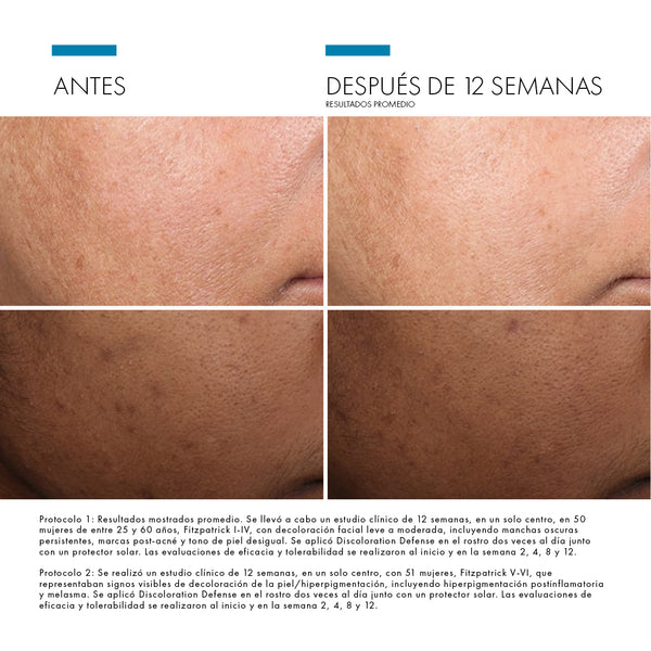 DISCOLORATION DEFENSE - Tratamiento para Manchas y Melasma