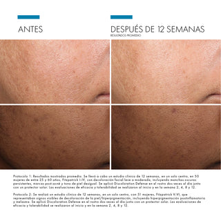 PACK LUMINOSIDAD & ANTIMANCHAS - PHLORETIN CF + DISCOLORATION DEFENSE + ADV BRIGHTENING + REGALO HA INTENSIFIER (MINI SIZE)