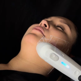 HIFU + PACK SKINCEUTICALS FIRMEZA