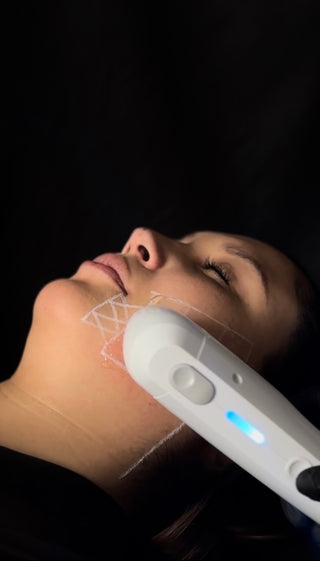 HIFU + PACK SKINCEUTICALS FIRMEZA