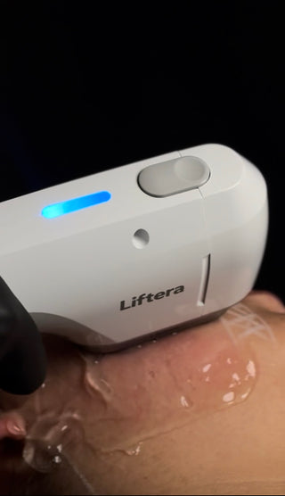 HIFU + PACK SKINCEUTICALS FIRMEZA