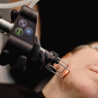 Láser CO₂ Coolpeel