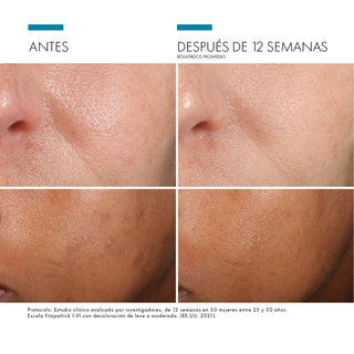 PACK LUMINOSIDAD & ANTIMANCHAS - PHLORETIN CF + DISCOLORATION DEFENSE + ADV BRIGHTENING + REGALO HA INTENSIFIER (MINI SIZE)