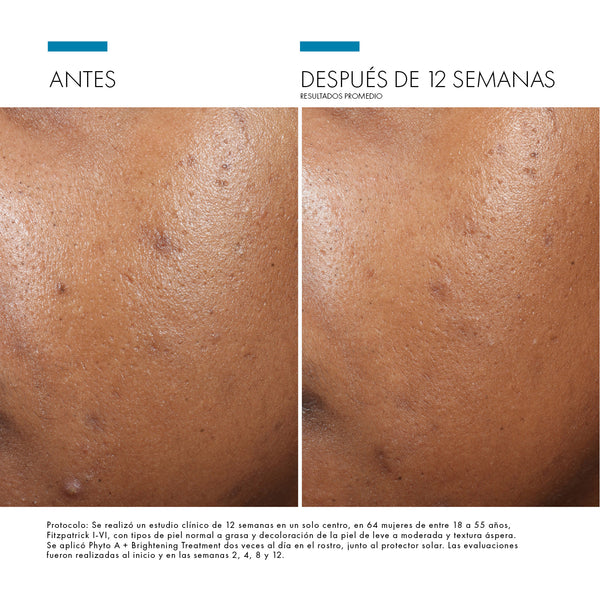 PHYTO A+ BRIGTHENING TREATMENT - Gel-Crema Iluminadora para Piel Grasa y Sensible