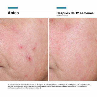 PACK REGENERATIVO - C E FERULIC + ADVANCED RGN-6 + REGALO DISCOLORATION DEFENSE (MINI SIZE)