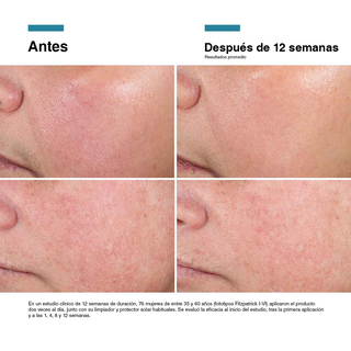 PACK REGENERATIVO - C E FERULIC + ADVANCED RGN-6 + REGALO DISCOLORATION DEFENSE (MINI SIZE)