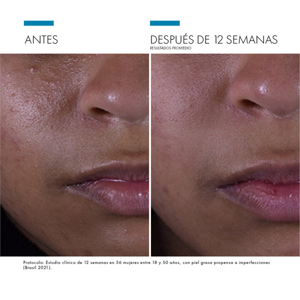 SILYMARIN CF - Antioxidante con Vitamina C para piel grasa
