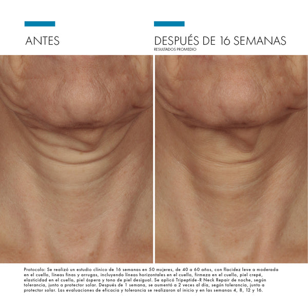TRIPEPTIDE-R NECK REPAIR - Crema Reafirmante con Retinol para Cuello y Escote