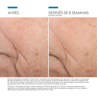 PACK NUTRICIÓN - C E FERULIC + TRIPLE LIPID RESTORE 2:4:2 + REGALO HA INTENSIFIER (MINI SIZE) - Vitamina C + Crema Restauradora de Lípidos