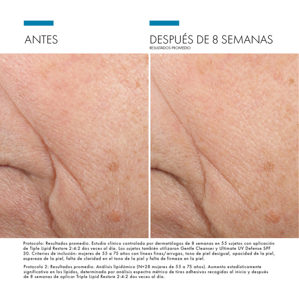 PACK NUTRICIÓN: C E FERULIC + TRIPLE LIPID RESTORE 2:4:2 + Regalo H.A Intensifier HALF size